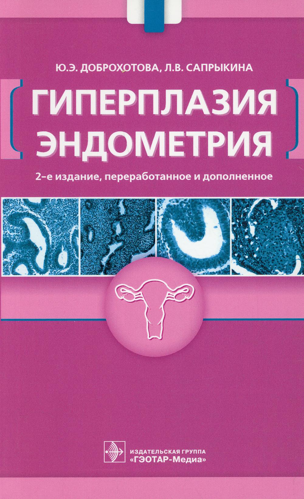Гиперплазия эндометрия — 2-е изд., перераб. и доп.